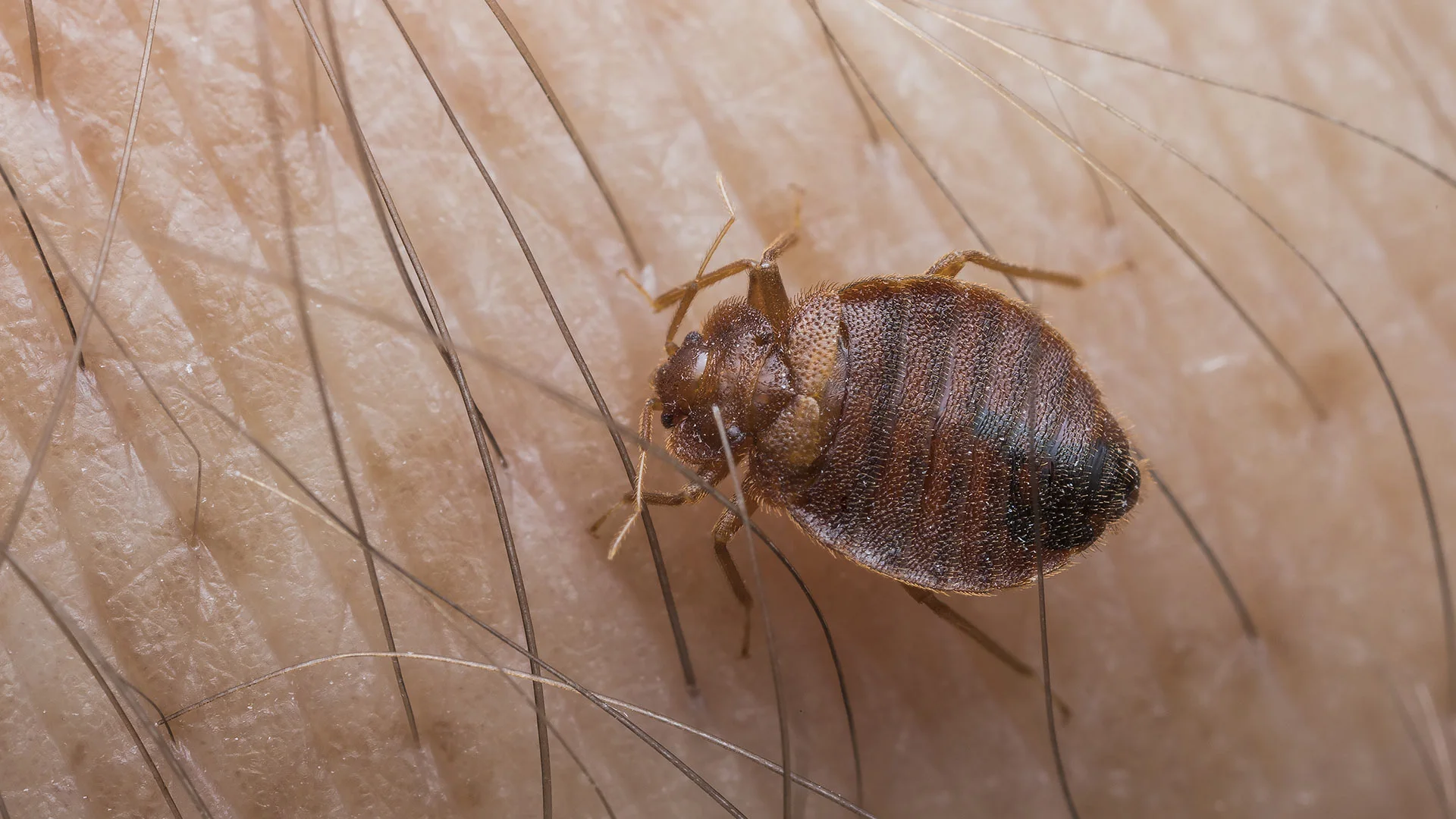 Bed bug crawling on a person's skin in Garland, TX.