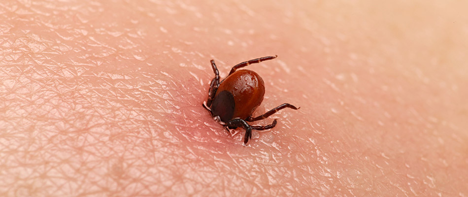 A flea entering a victim's skin in Allen, TX.